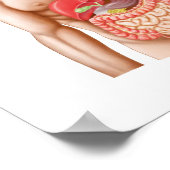 Medische isolatie van een Hiatale Hernia in de Poster (Hoek)