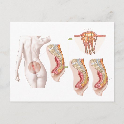 Medische isolatie van een proefcyclus briefkaart (Voorkant)