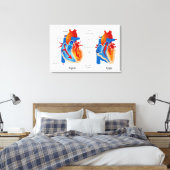 Medische kaart met hartbloeding canvas afdruk (Insitu (Slaapkamer))