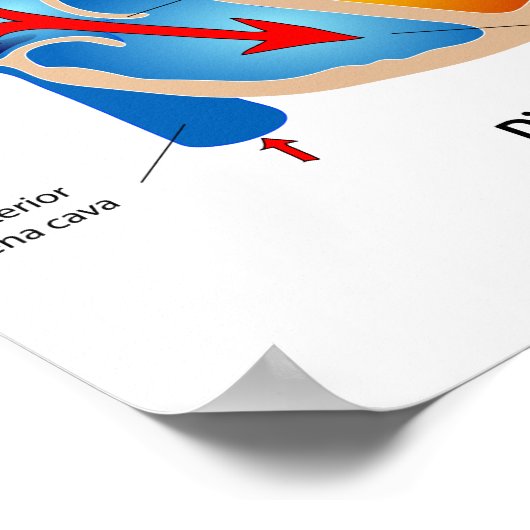 Medische kaart met hartbloeding poster (Hoek)