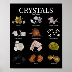 Medische Lab Urine Kristal Laboratorium Tech Weten Poster