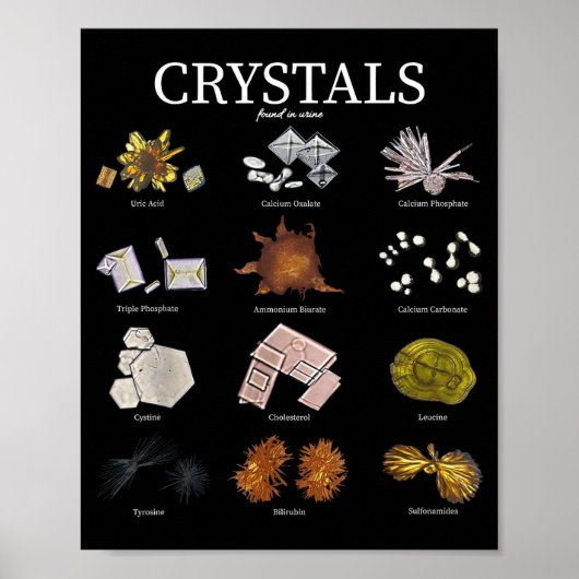 Medische Lab Urine Kristal Laboratorium Tech Weten Poster (Voorkant)