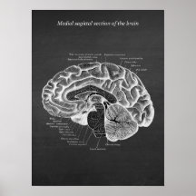 Medische Sagittal Sectie van de Brain print nr. 2