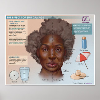 Melalogic De effecten van zonschade Medisch Poster