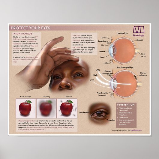 Melalogic Eye Protection Medical Poster (Voorkant)
