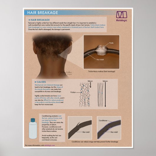 Melalogic Hair Breakage Medical Poster (Voorkant)