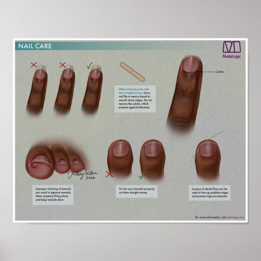Melalogic Nail Care Medical Poster (Voorkant)