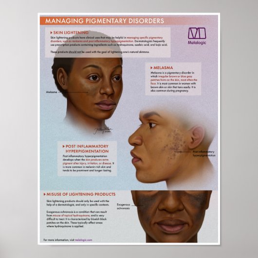 Melalogic Skin Lightening Medical Poster (Voorkant)