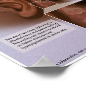 Melalogische seborrheic dermatitis (roos) Medisch Poster (Hoek)