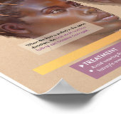 Melalogische tractie Alopecia Medisch Poster (Hoek)