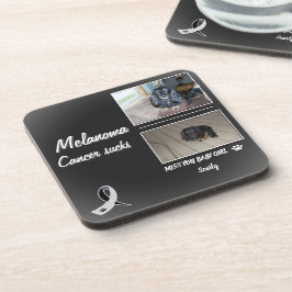 Melanoma Pet Memorial with Two Photos Bier Onderzetter