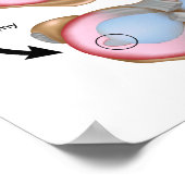 Meniscus scheur en Poster voor chirurgie (Hoek)