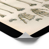  menselijke anatomie Afdrukarm handbediende Botten Poster (Hoek)