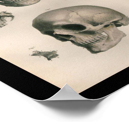  menselijke anatomie Afdrukschedel Botten Poster (Hoek)