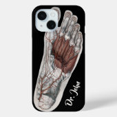  menselijke anatomie Voetafdruk podiatry Foot Case-Mate iPhone Case (Achterkant)