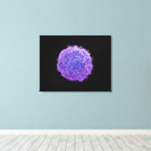 Menselijke huidkanker canvas afdruk (Insitu (Houten vloer))