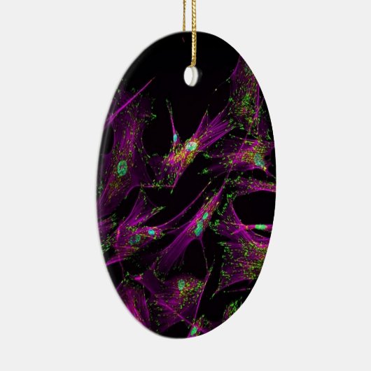 Menselijke longfibroblasten keramisch ornament (Rechts)