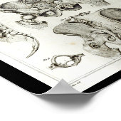 Menselijke ruggengraat bekken anatomie print (Hoek)