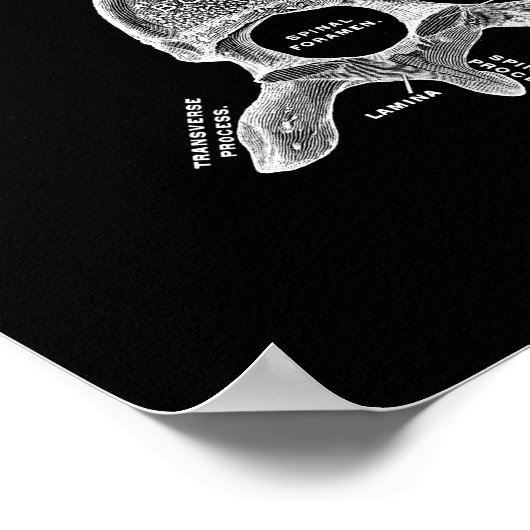 Menselijke vertebrae-anatomie in zwart-wit afdrukk poster (Hoek)