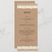 Menu  ivoorzijde & middelmatige overlapping (Voorkant / Achterkant)