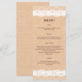 Menu Lichte overlapping en  kant 2 (Voorkant / Achterkant)