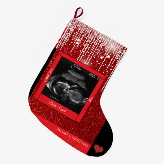 Merry Christmas Sonogram Baby komt eraan Grote Kerstsok (Voorkant (Hangend))
