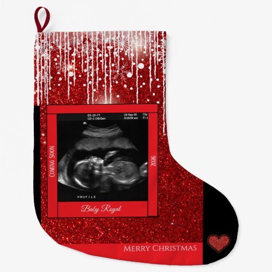 Merry Christmas Sonogram Baby komt eraan Grote Kerstsok (Voorkant)