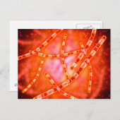 Microscopisch Uitzicht van antrax 1 Briefkaart (Voorkant / Achterkant)