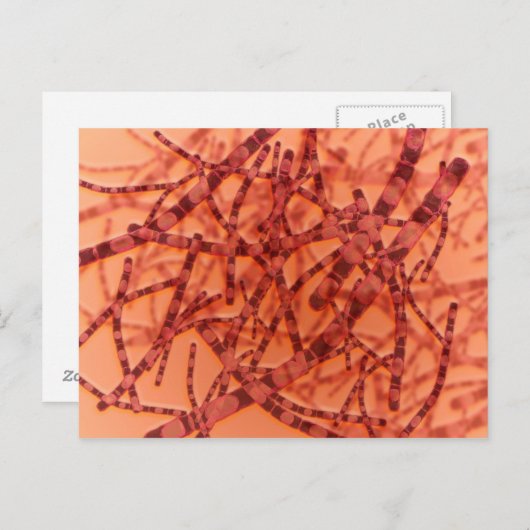 Microscopisch Uitzicht van antrax 3 Briefkaart (Voorkant / Achterkant)