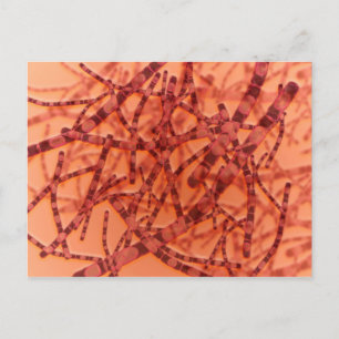 Microscopisch Uitzicht van antrax 3 Briefkaart