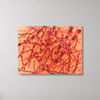 Microscopisch Uitzicht van antrax 3