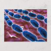 Microscopisch Uitzicht van bacteriële pneumonie 1 Briefkaart (Voorkant)