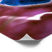 Microscopisch Uitzicht van bacteriële pneumonie 1 Poster (Hoek)