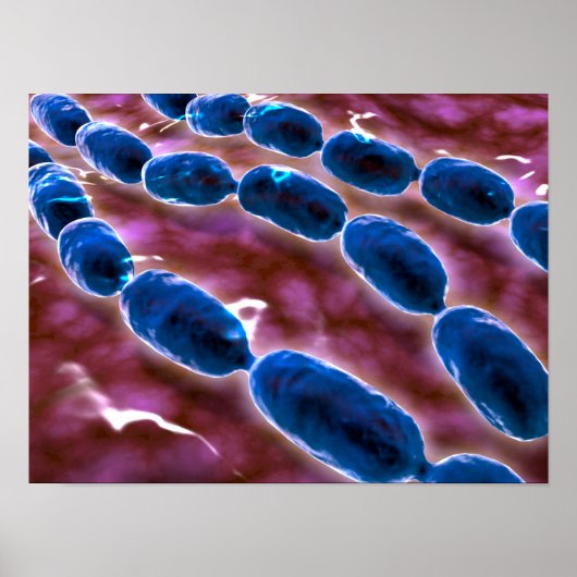 Microscopisch Uitzicht van bacteriële pneumonie 1 Poster (Voorkant)