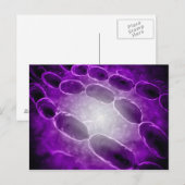 Microscopisch Uitzicht van bacteriële pneumonie 2 Briefkaart (Voorkant / Achterkant)