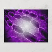 Microscopisch Uitzicht van bacteriële pneumonie 2 Briefkaart (Voorkant)