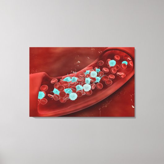 Microscopisch Uitzicht van bloeduitzetting Canvas Afdruk (Voorkant)