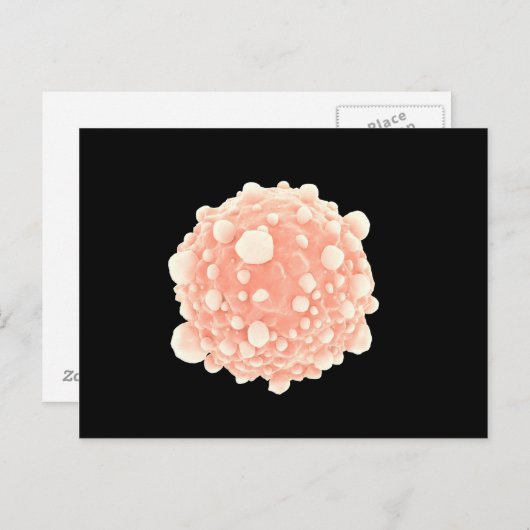Microscopisch Uitzicht van de Pancreaskankercel Briefkaart (Voorkant / Achterkant)