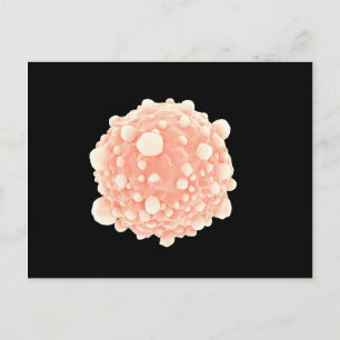 Microscopisch Uitzicht van de Pancreaskankercel Briefkaart