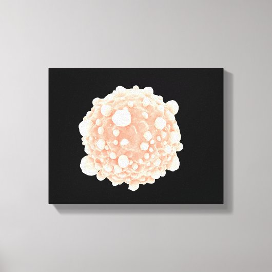Microscopisch Uitzicht van de Pancreaskankercel Canvas Afdruk (Voorkant)