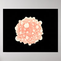 Microscopisch Uitzicht van de Pancreaskankercel