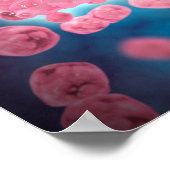 Microscopisch Uitzicht van een groep leukemiecelle Poster (Hoek)