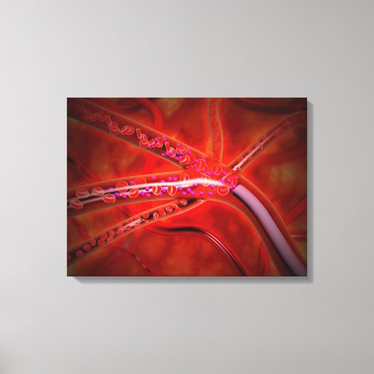 Microscopisch Uitzicht van het geïnjecteerde genee Canvas Afdruk (Voorkant)