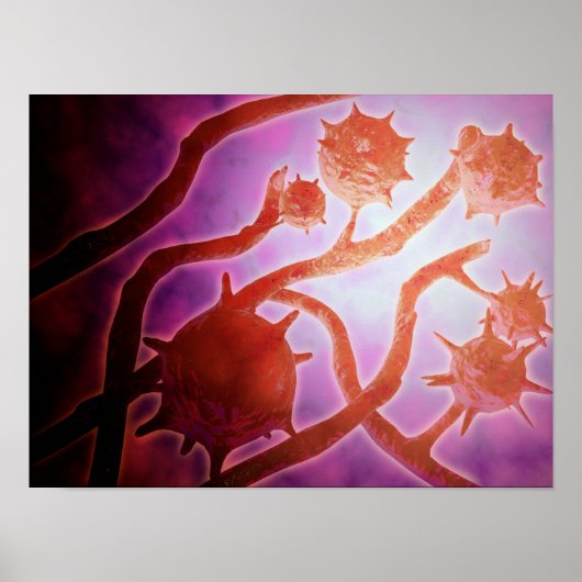 Microscopisch Uitzicht van histoplasmose Poster (Voorkant)