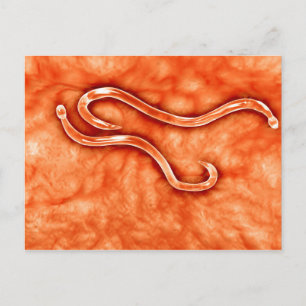Microscopisch Uitzicht van Hookworm 2 Briefkaart