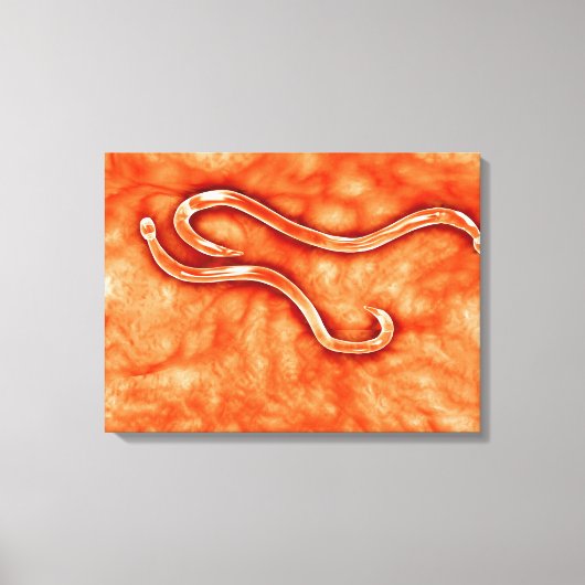 Microscopisch Uitzicht van Hookworm 2 Canvas Afdruk (Voorkant)