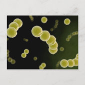 Microscopisch Uitzicht van Streptococcus 1 Briefkaart (Voorkant)