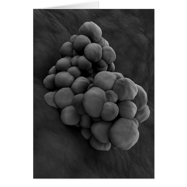 Microscopisch Uitzicht van tumor 1 (Voorkant)