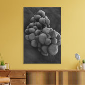 Microscopisch Uitzicht van tumor 1 Canvas Afdruk (Insitu (Woonkamer))