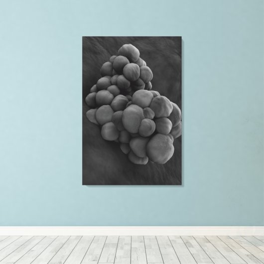 Microscopisch Uitzicht van tumor 1 Canvas Afdruk (Insitu (Houten vloer))